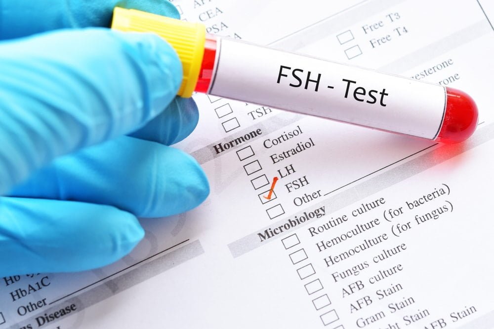 FSH Levels