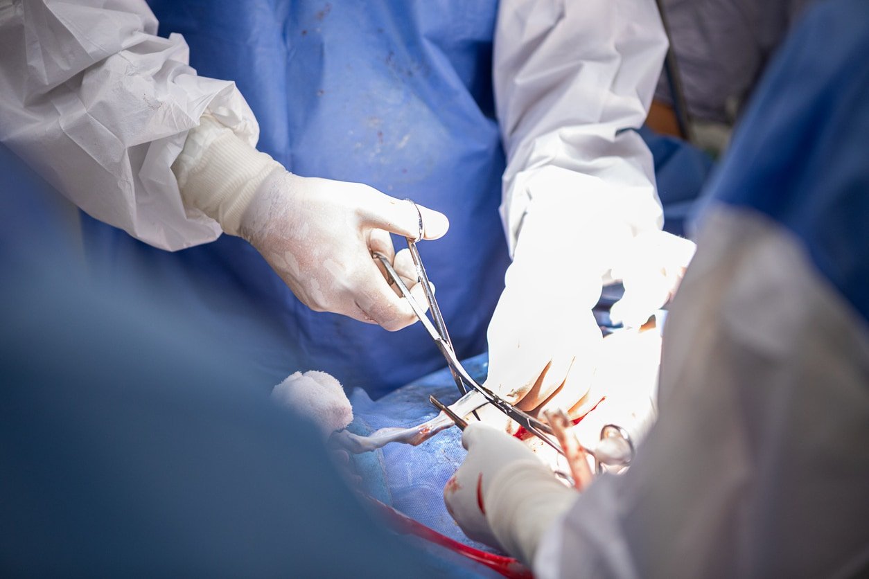 Médicos realizando uma cesariana na sala de cirurgia