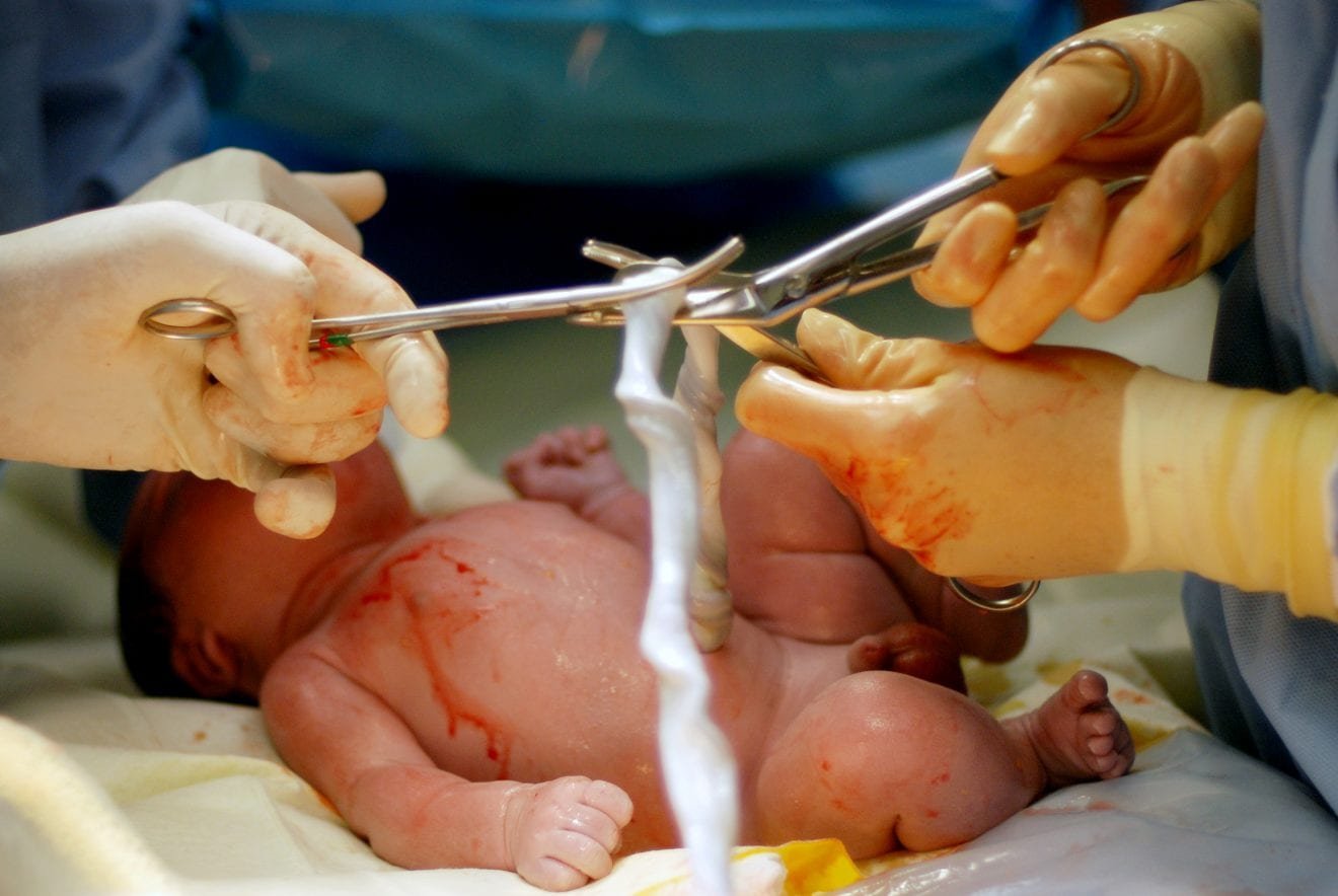 Obstetricians cutting the umbilical cord of a newborn baby boy after an caesarean section birth at a modern hospital. Baby is lying on mother