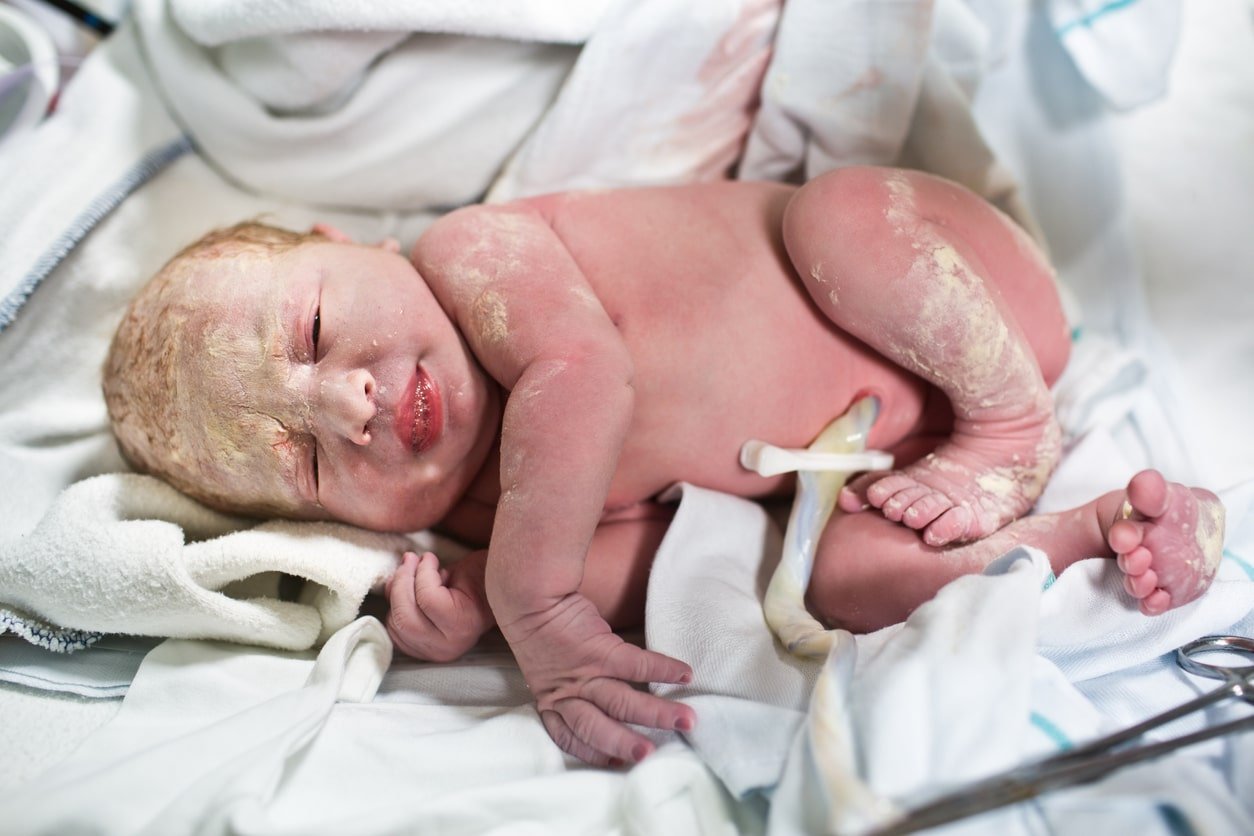 Bebê recém-nascido com cordão umbilical
