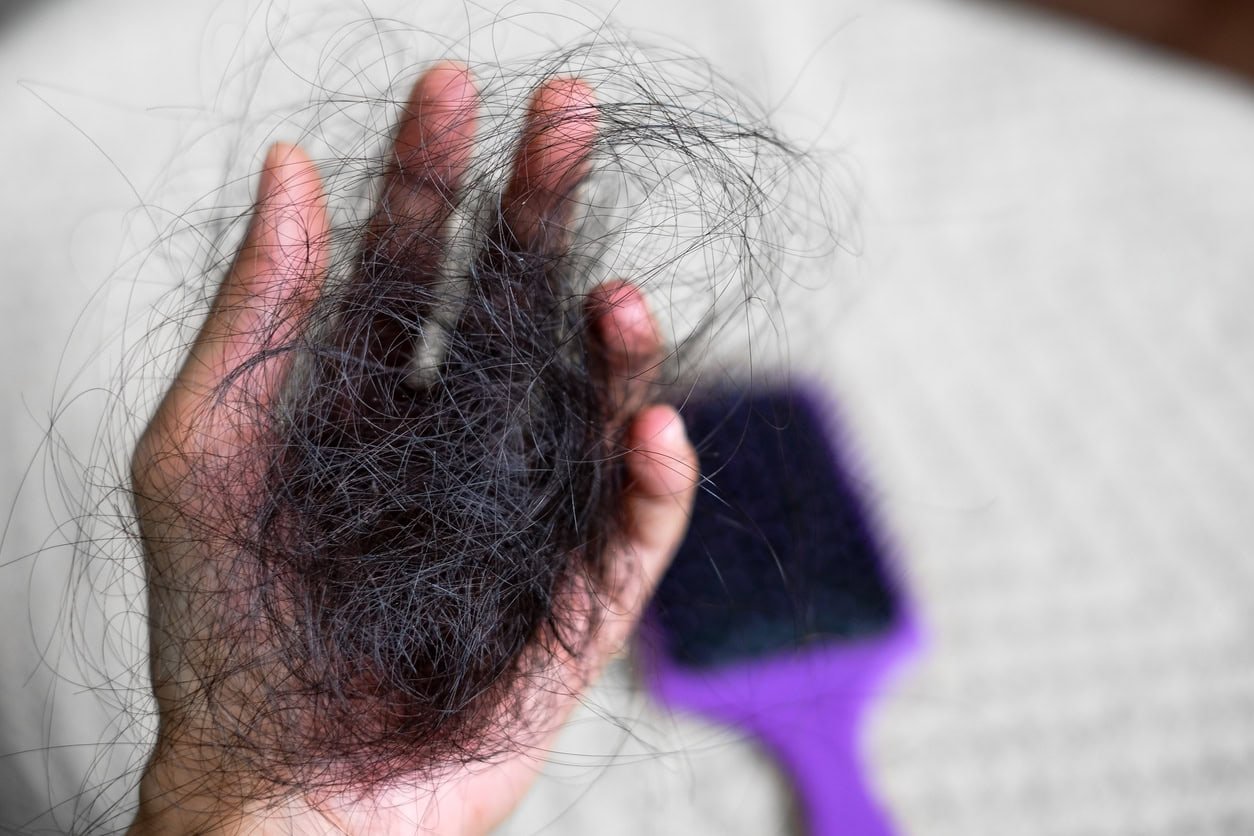 Perda de cabelo feminina disponível, problema de queda de cabelo.