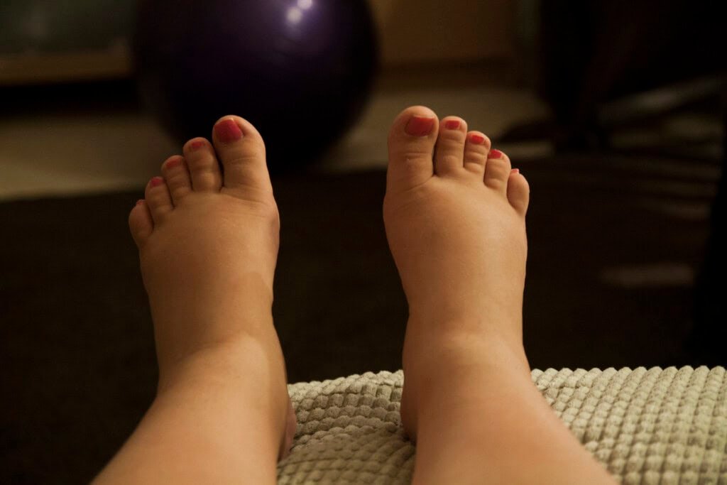 Uma imagem em close mostrando os pés inchados de uma pessoa grávida, ambos adornados com esmalte vermelho. Os pés ficam em uma superfície texturizada de cor clara com um piso escuro e uma bola de exercícios roxa ao fundo.
