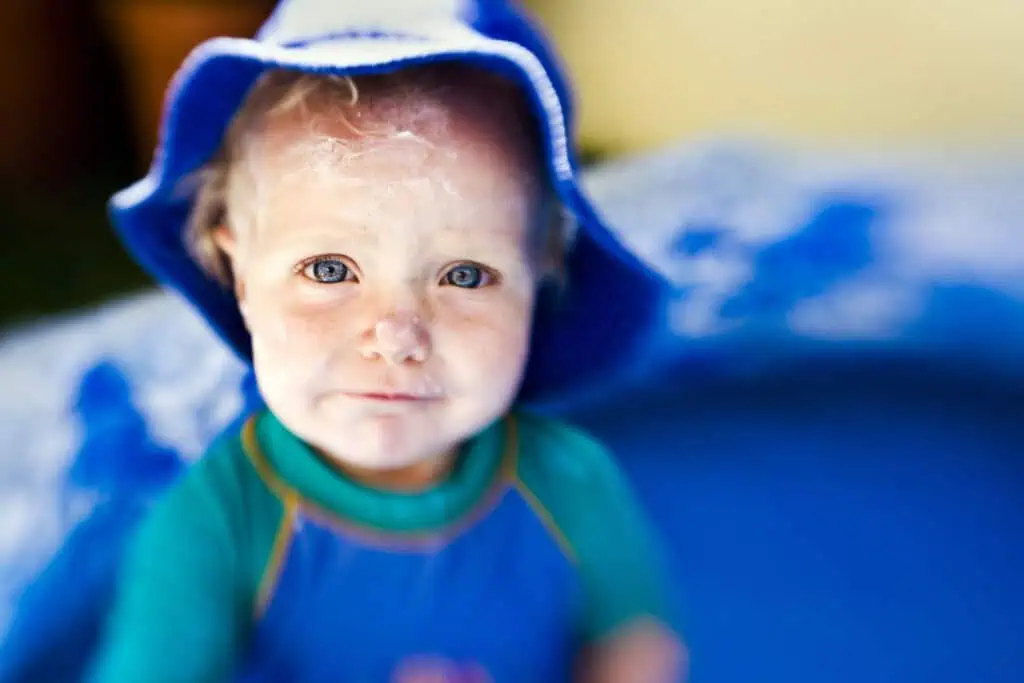 Uma criança de cabelos claros usa um chapéu azul e uma camisa verde e azul, sentada em uma pequena piscina inflável. Seu rosto é coberto com protetor solar para ajudar a prevenir erupções cutâneas enquanto eles aproveitam a água sob o olhar quente do sol. O fundo permanece suavemente desfocado.